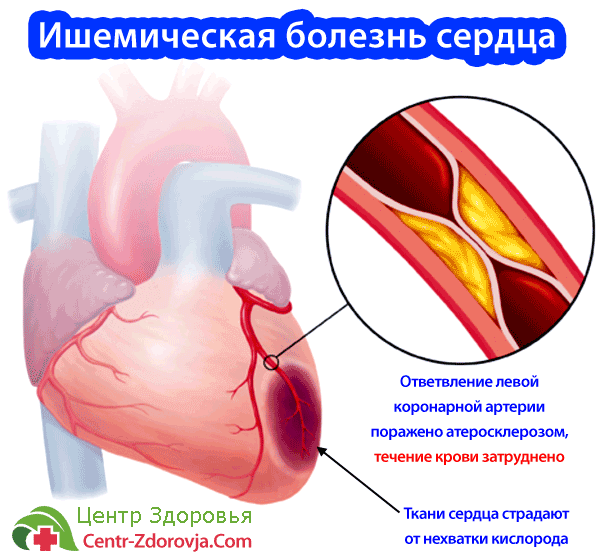 Кулагин Анатолий Боль души