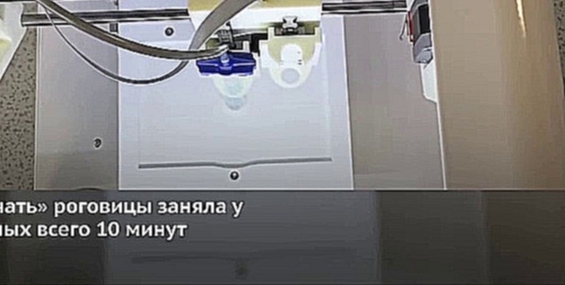 Учёные распечатали роговицу человеческого глаза на 3D-принтере 