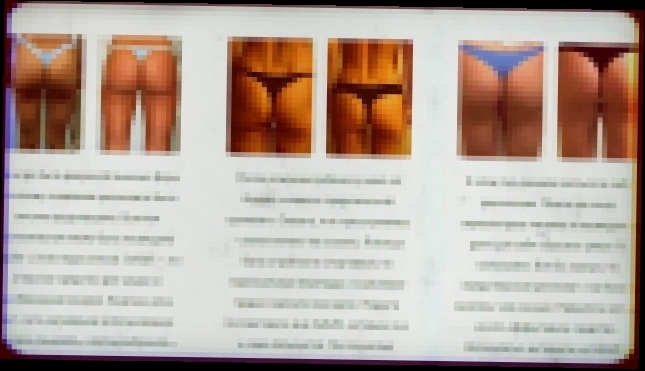 ЦЕЛЛЮЛИТ! ЧТО БЫСТРО ПОБЕЖДАЕТ ЦЕЛЛЮЛИТ Cellufit - избавит от «эффекта апельсиновой корки»! 