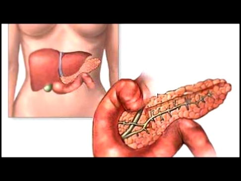 Симптомы панкреатита у женщины 