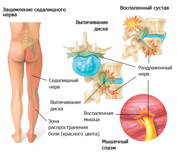 Нервы Срываюсь с уст