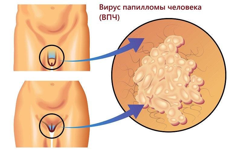 Ногу Свело Мужской половой орган(мат) ^^